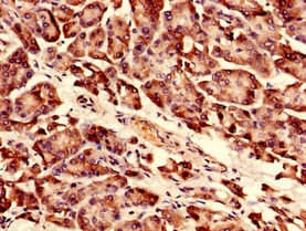 Polyclonal Rabbit anti-Human RPLP0 Antibody (aa1-317)