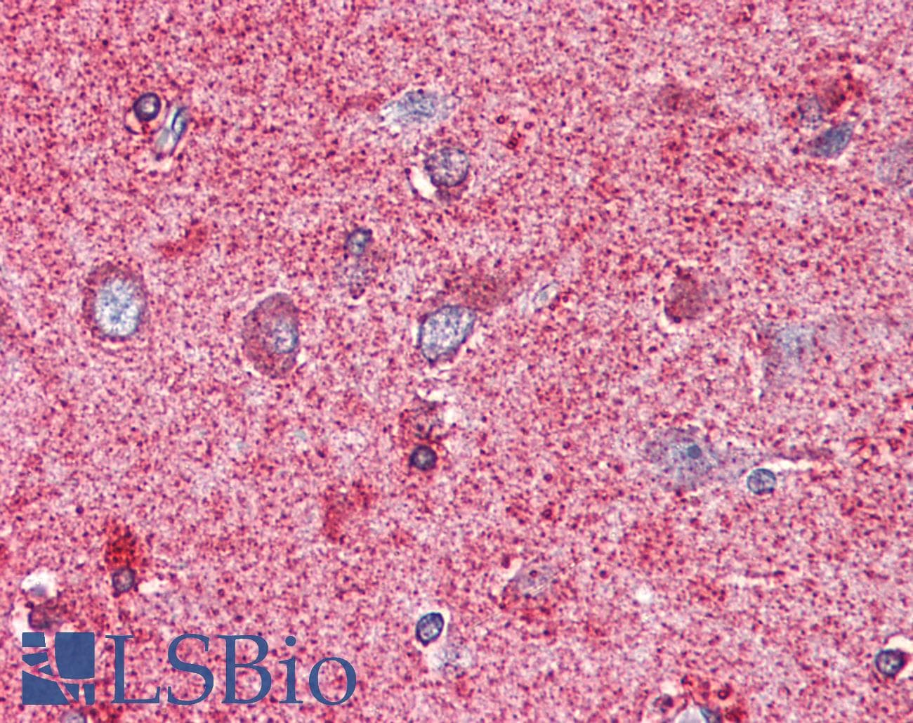 IHC-plus™ PAK7/PAK5 Antibody (Internal)