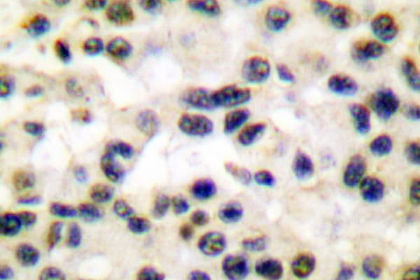 Polyclonal Rabbit anti-Human FOS / c-FOS Antibody (Phe3, IHC, WB)