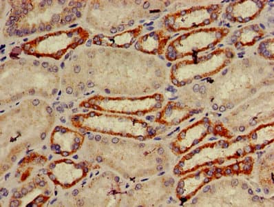 Polyclonal Rabbit anti-Human TRIM39 / RNF23 Antibody (IHC, IF, WB)