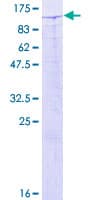 Human ZBTB33 / Kaiso Protein (Recombinant GST)