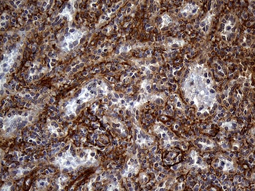 Gravin / AKAP12 Antibody (aa266-557, clone OTI1B6)