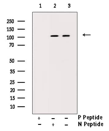 SIRT1 / Sirtuin 1 Antibody (phospho-Ser47)
