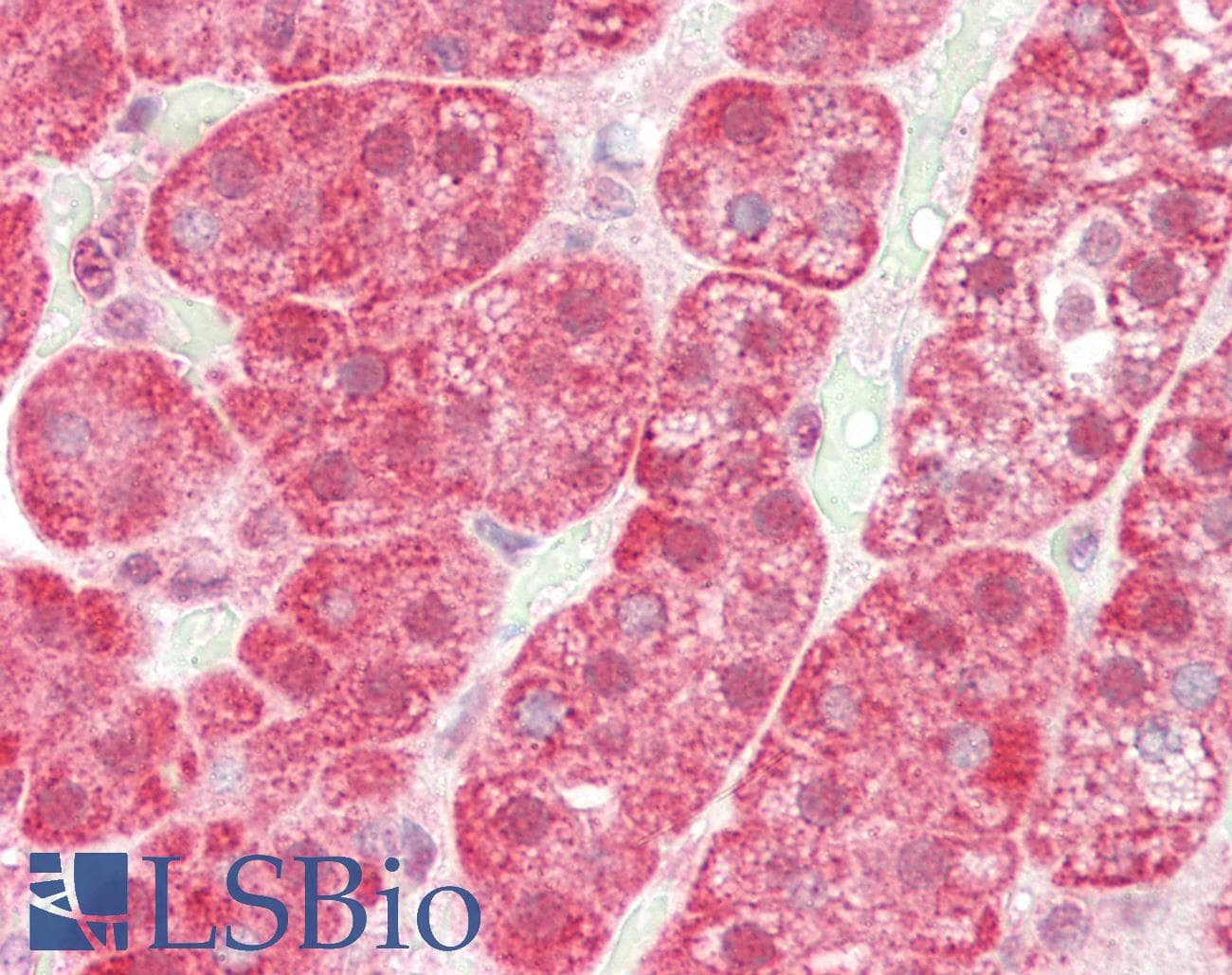 IHC-plus™ SLITRK4 Antibody