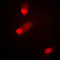 MAP2K4 / MKK4 Antibody (phospho-Ser80)