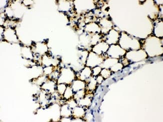 Polyclonal Rabbit anti-Human SFTPA1 + SFTPA2 Antibody (IHC, WB)