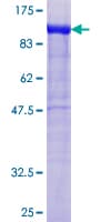 Human WASF2 / SCAR2 Protein (Recombinant GST)