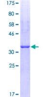 Human HAS2 Protein (Recombinant GST, N-terminus)