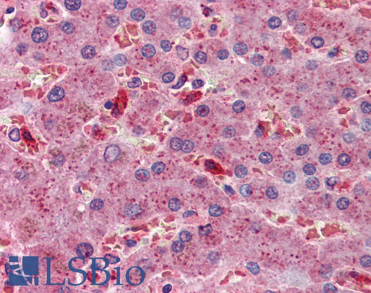 IHC-plus™ ALCAM / CD166 Antibody (clone 3F8B12)