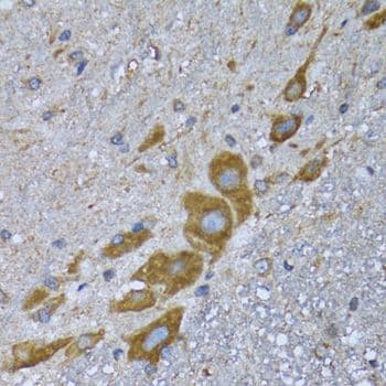 Polyclonal Rabbit anti-Human GCN2 Antibody (IHC, IF, WB)