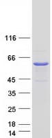 Human UAP1L1 Protein (Recombinant Myc-DDK (Flag))