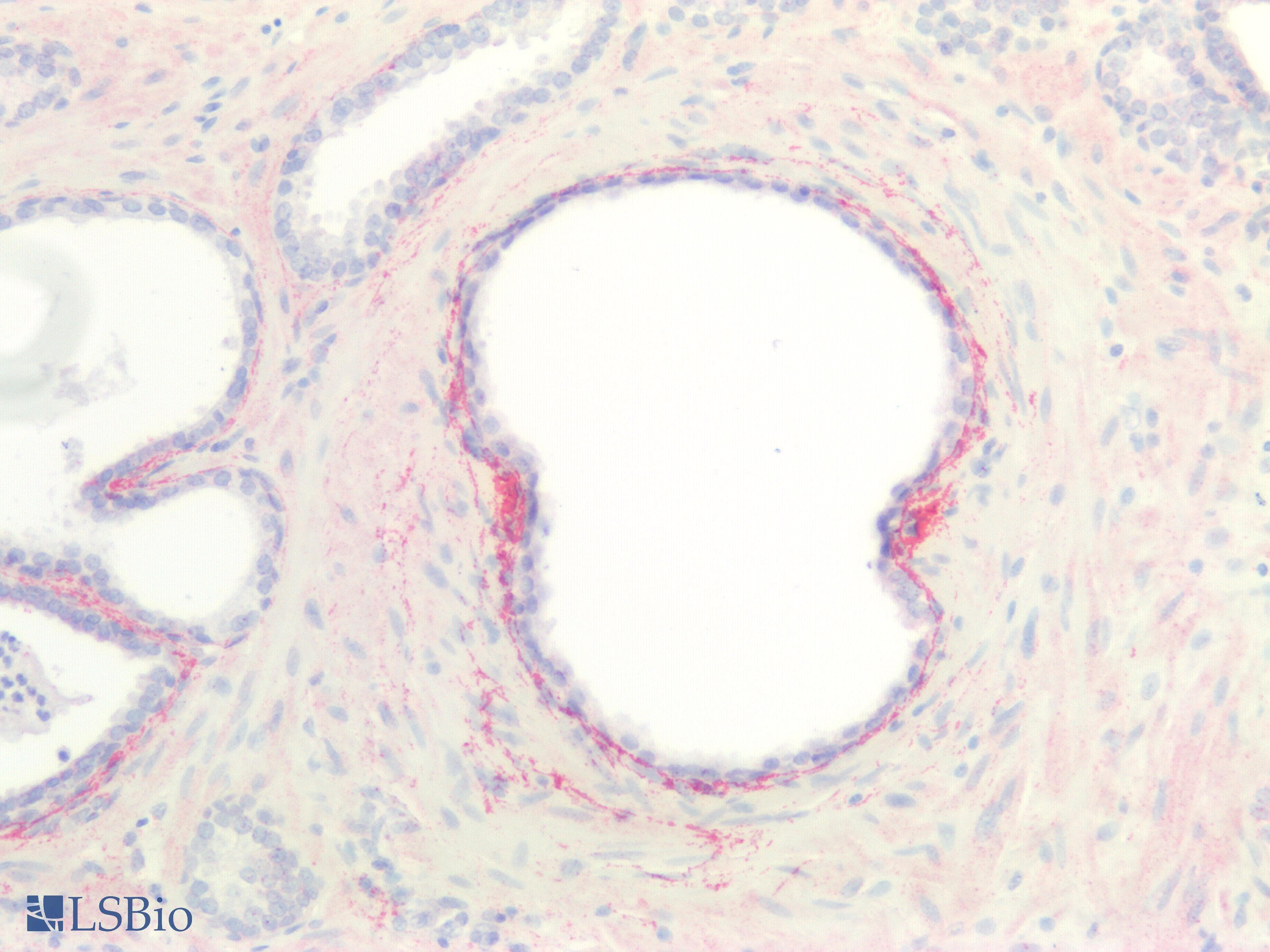PathPlus™ COL8A1 / Collagen VIII Alpha 1 Antibody (aa583-743)
