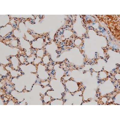 Polyclonal Rabbit anti-Human FLNA / Filamin A Antibody (phospho-Ser2152, IHC, IF, WB)