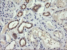 TRIM38 Antibody (clone OTI2G9)