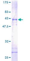Human PIG8 / EI24 Protein (Recombinant GST)