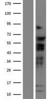TCF7L2 / TCG4 Protein (Over-Expression Lysate Myc-DDK (Flag))
