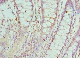 SMC1A / SMC1 Antibody (aa1-130)