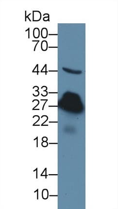 CRP / C-Reactive Protein Antibody (aa20-230)