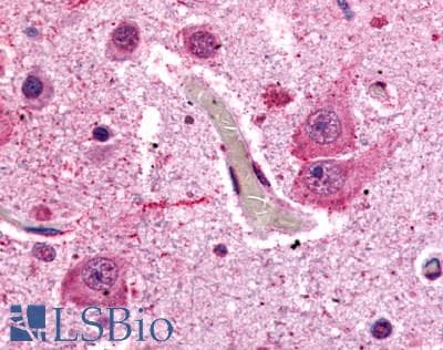 IHC-plus™ Polyclonal Rabbit anti-Human GRM1 / MGLUR1 Antibody (C-Terminus, IHC)