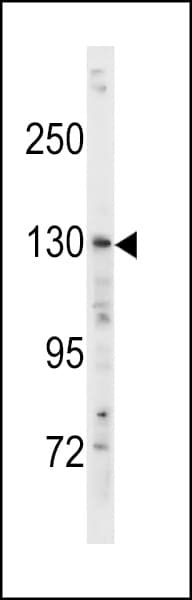 Hamartin / TSC1 Antibody (aa395-424)