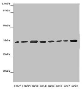 Polyclonal Rabbit anti-Human ETFA Antibody (IHC, WB)