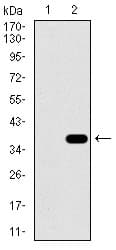 Monoclonal Mouse anti-Human SLC27A5 / BACS Antibody (clone 9C4D1, aa508-570, IHC, WB)