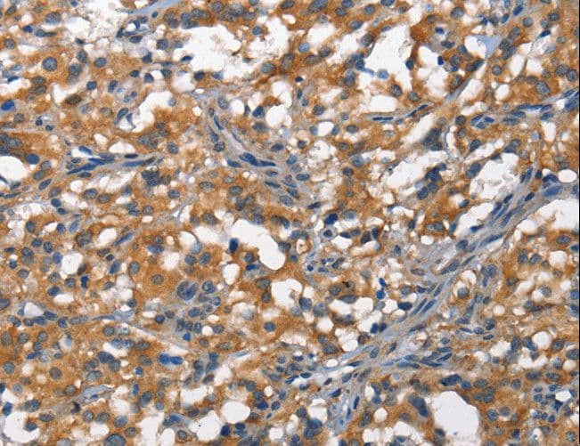 DDR2 Antibody