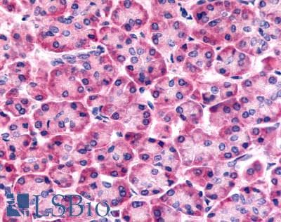 PathPlus™ Polyclonal Rabbit anti-Human FZD6 / Frizzled 6 Antibody (N-Terminus, IHC)