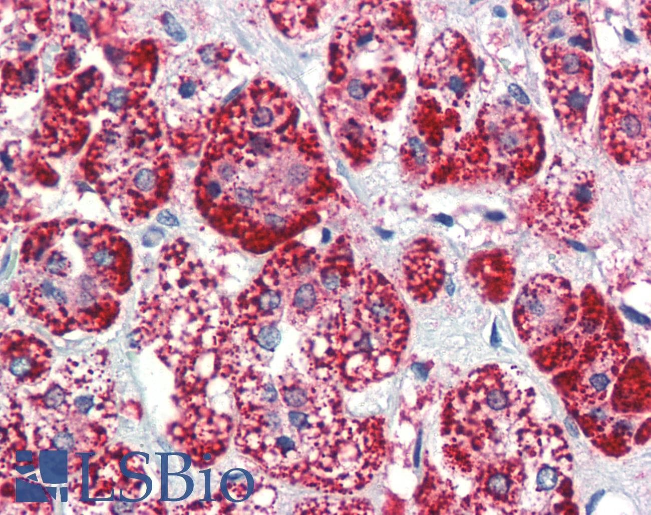 PathPlus™ Monoclonal Mouse anti-Human HSPD1 / HSP60 Antibody (clone LK1, IHC, WB)