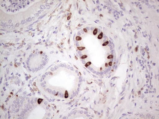 PTGS2 / COX2 / COX-2 Antibody (aa18-260, clone OTI5F12)