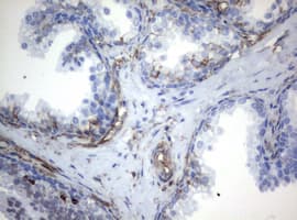 Monoclonal Mouse anti-Human Vimentin Antibody (clone OTI5D7, IHC, WB)