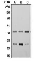 Polyclonal Rabbit anti-Human TMEM173 / STING Antibody (C-Terminus, WB)