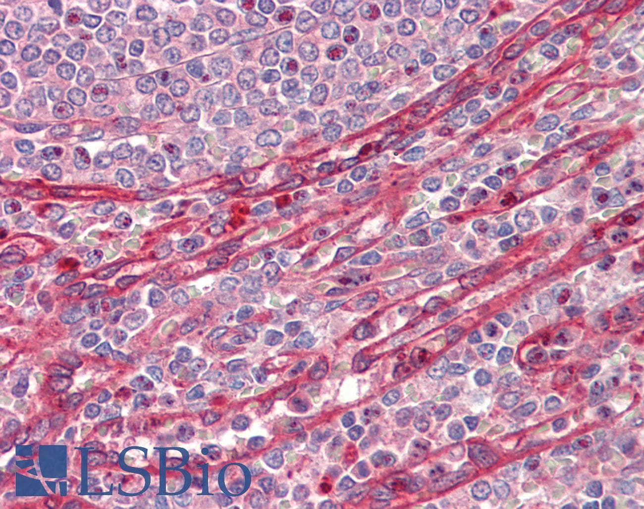 IHC-plus™ ADAM19 Antibody
