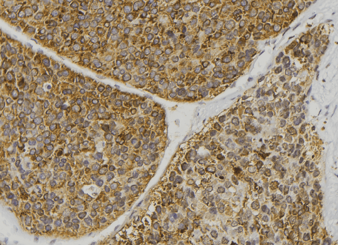 MAP3K5 / ASK1 Antibody