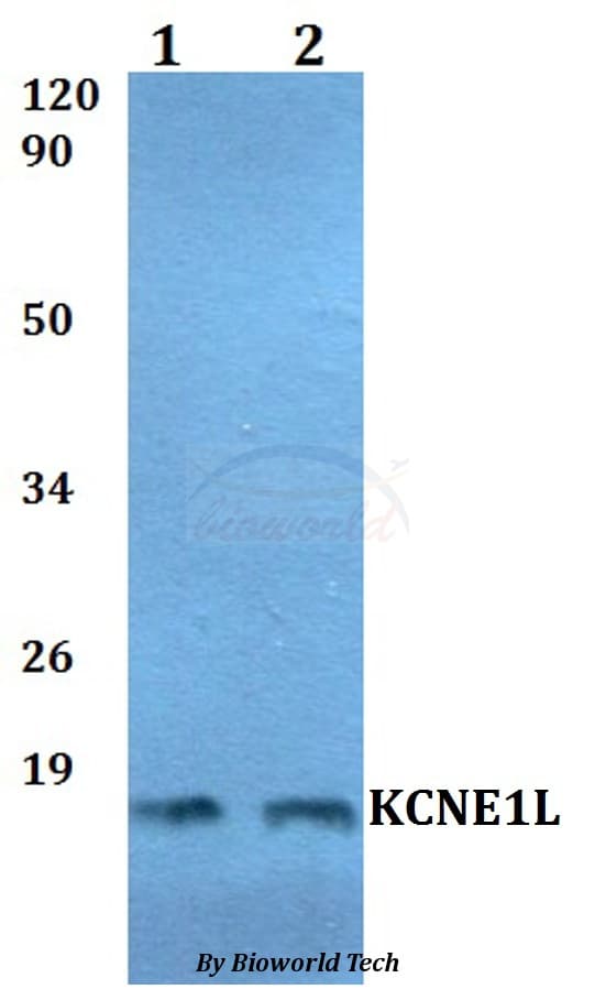 Polyclonal Rabbit anti-Human KCNE5 Antibody (WB)