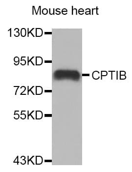 CPT1B Antibody