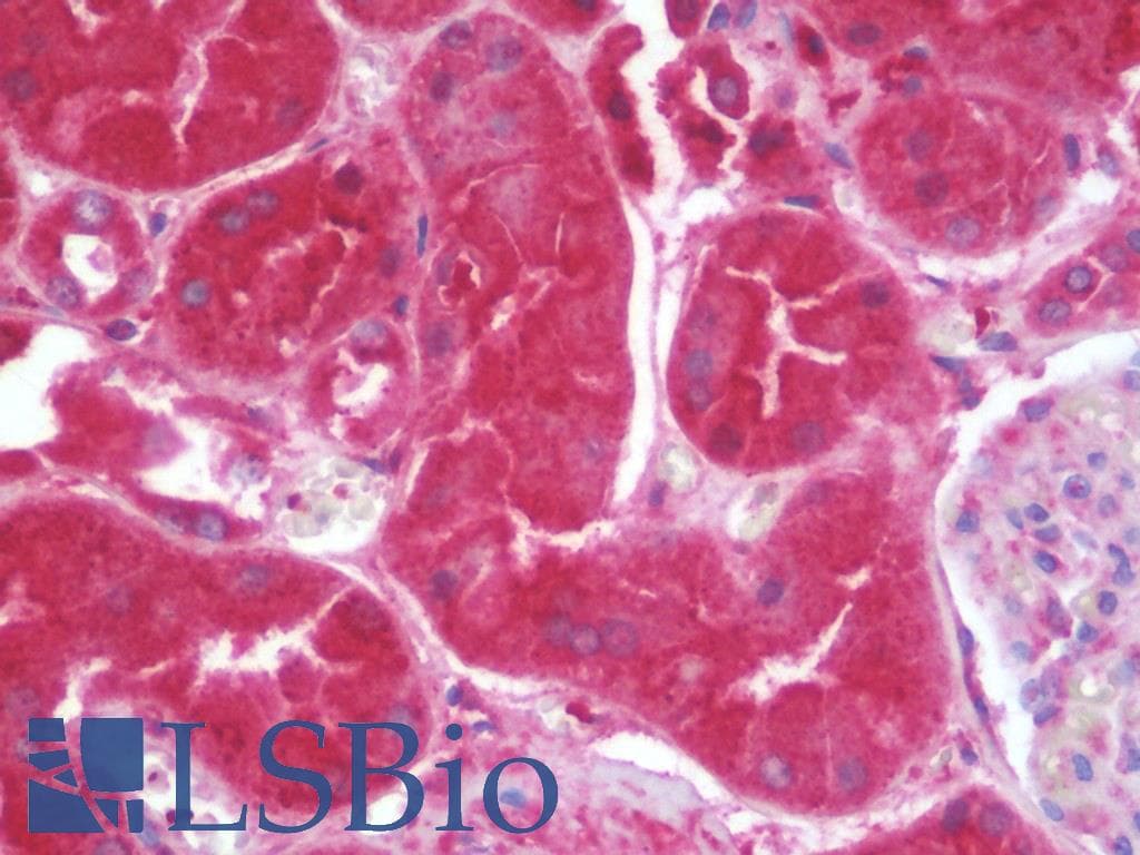 PathPlus™ SPP1 / Osteopontin Antibody