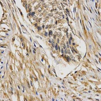 Polyclonal Rabbit anti-Human STXBP1 / MUNC18-1 Antibody (IHC, WB)