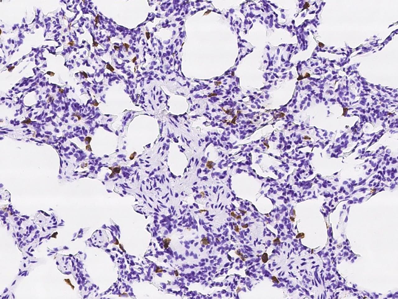 Monoclonal Mouse anti-Human CD68 Antibody (clone 11, Preservative Free, IHC)