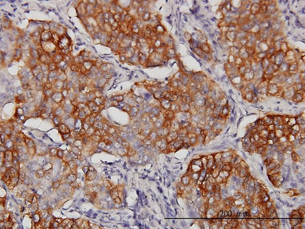EIF4G3 Antibody (clone 1H5)