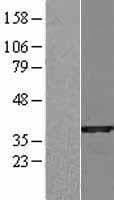 SULT1B1 / Sulfotransferase 1B1 Protein (Over-Expression Lysate Myc-DDK (Flag))