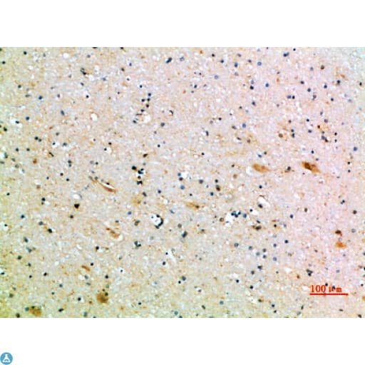 CD1B Antibody
