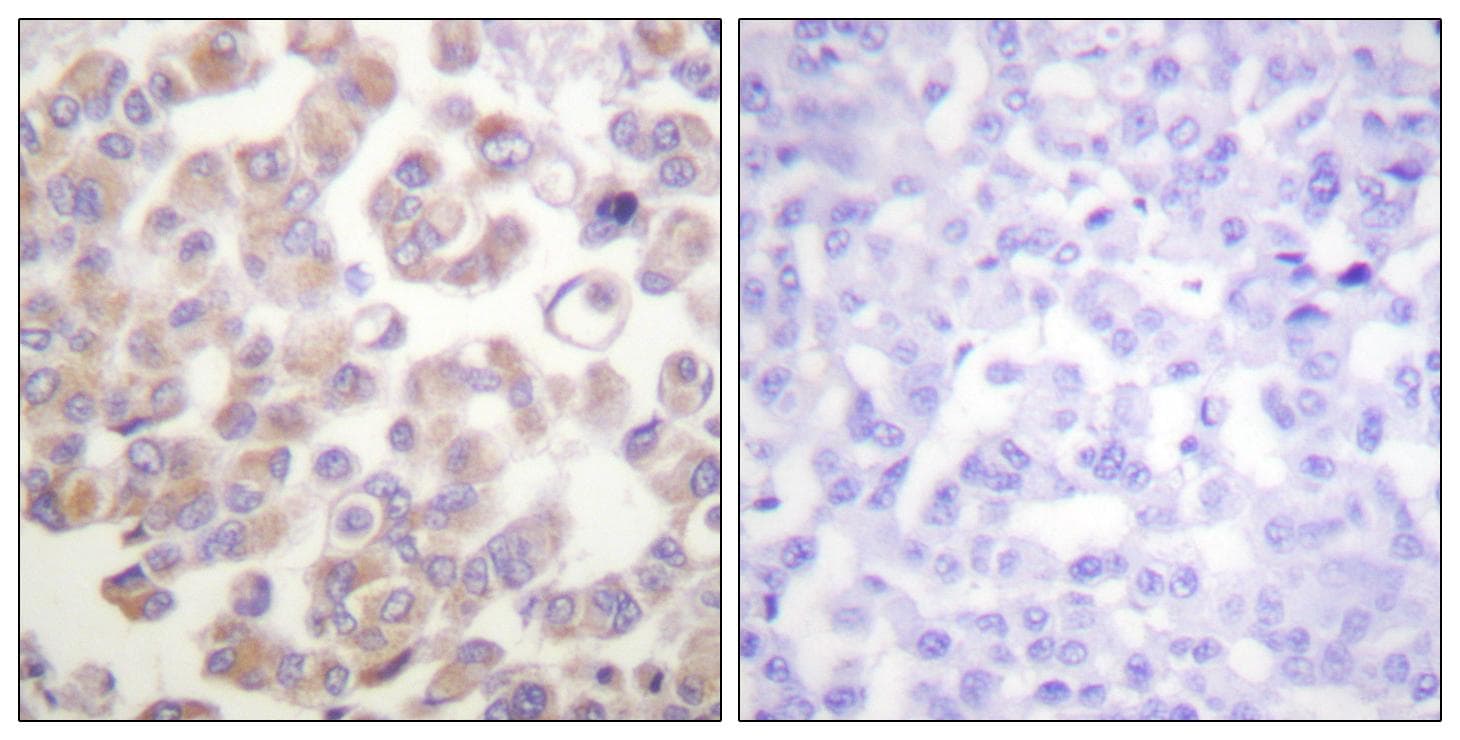 WNT1 Antibody