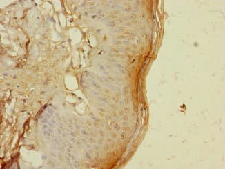 TIGD4 Antibody