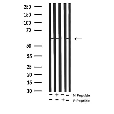 Polyclonal Rabbit anti-Human DOK2 Antibody (phospho-Tyr299, WB)