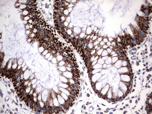 HADH Antibody (aa57-314, clone UMAB151, Carrier-free)