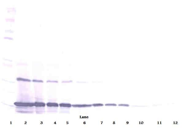 CCL2 / MCP1 Antibody (Biotin)