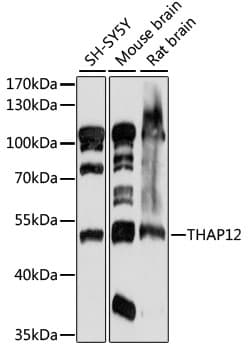 PRKRIR Antibody
