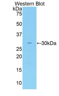 F5 / Factor Va Antibody (aa1979-2217)