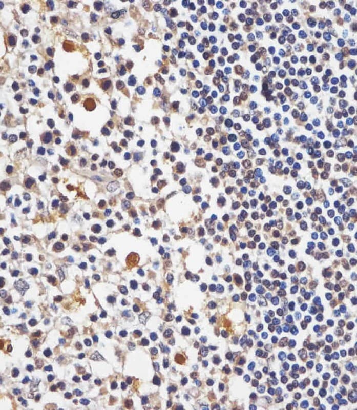 TAF4 Antibody (C-Terminus)